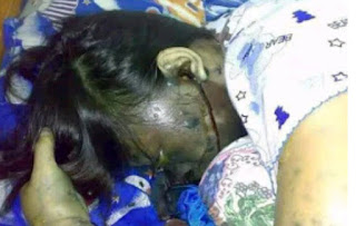 Woman-electrocuted-by-mobile-phone-earpiece-while-sleeping-on-HWN-SAFETY