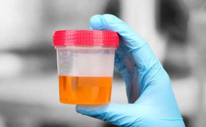 Colours-Of-Urine-And-Their-Health-Status-Indications-on-HWN-INSIGHTS