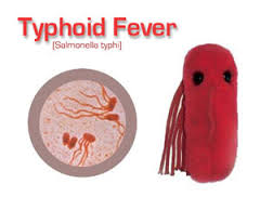 Strange-typhoid-fever-kills-DELSU-lecturer-on-HWN-WONDERS