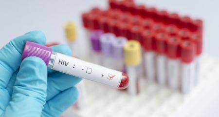 British-man-undergoes-pioneering-treatment-to-cure-HIV-on-HWN-HIV-UPDATE