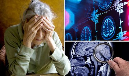 Almighty-novel-magnetic-brain-training-technique-for-Alzheimers-patients-on-HWN-ALZHEIMERS