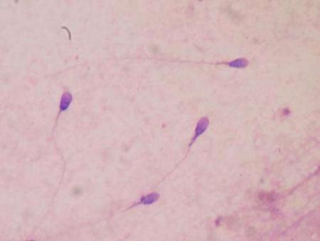 Scientists-creates-human-sperm-on-HWN-MEDICAL-INNOVATIONS