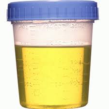 Urine-therapy-might-be-the-missing-key-on-HWN-INSIGHTS