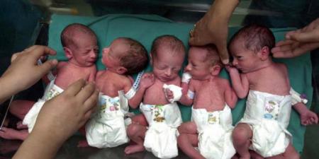 UCH-writes-off-medical-bills-of-quintuplets-and-their-mother-on-HWN-HUMANITY