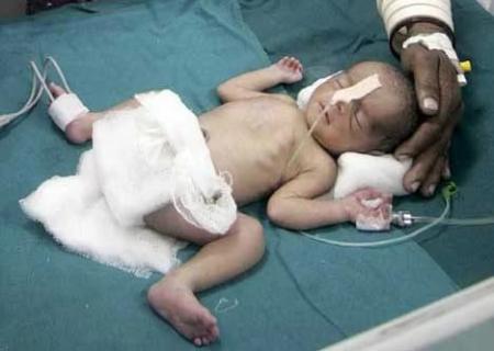 New-Born-Survives-Fall-From-Moving-Train-Soon-After-Birth-on-HWN-WONDERS