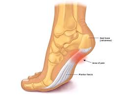 Plantar-Fasciitis-(Heel-Pain)-And-Relieving-Exercises-on-HWN-SPORTS