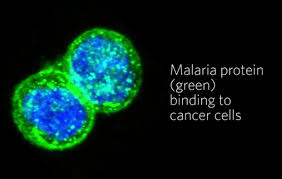 Malaria-protein-that-destroys-cancer-cells-on-HWN-RESEARCH