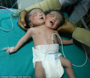 Baby-born-with-two-heads-and-one-single-body-in-Bangladesh-on-HWN-BREAKING