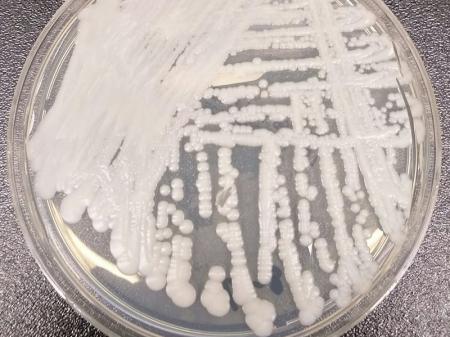 New-Infectious-Fungus-Emerges-In-USA-on-HWN-BREAKING