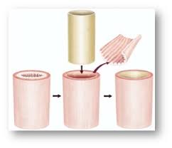 Reported-in-Human,-First-Ever-Esophageal-Regeneration-on-HWN-INNOVATIONS