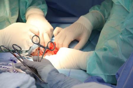 Scissors-discovered-inside-Patient-Stomach-after-18-years-on-HWN-SURGERY